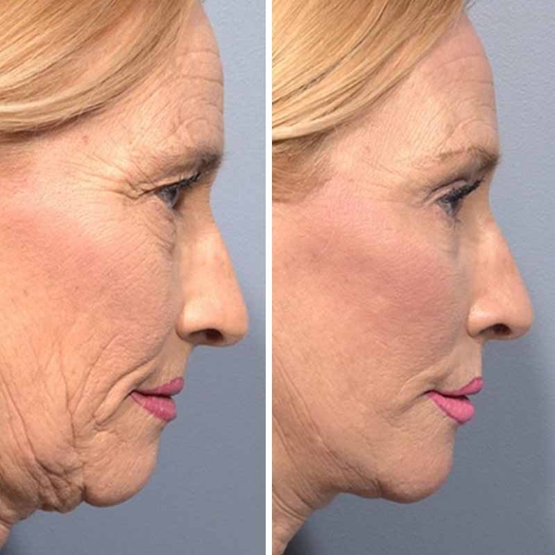 WhatsApp Image 2023-06-24 at 7.35.11 PM (1)