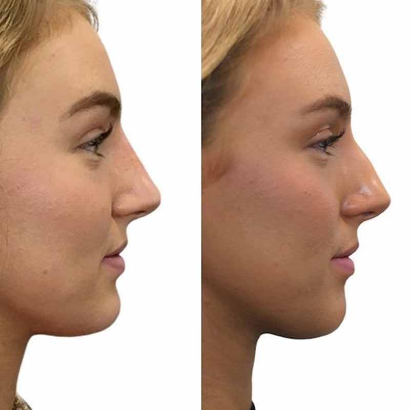 WhatsApp Image 2023-06-24 at 7.35.11 PM (2)