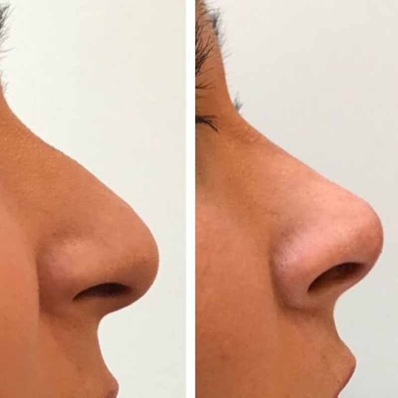 WhatsApp Image 2023-06-24 at 7.35.11 PM