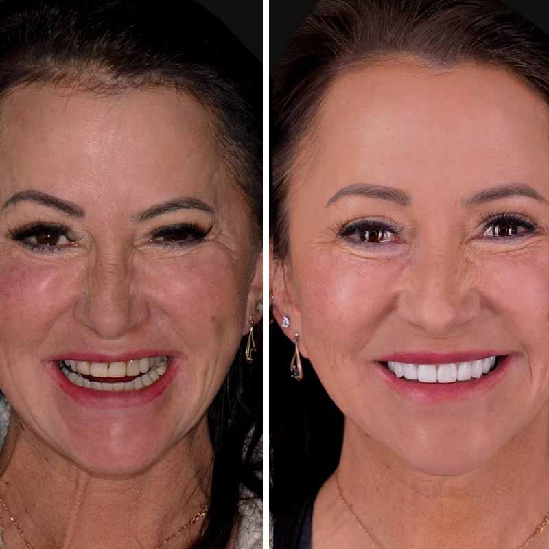 WhatsApp Image 2023-06-24 at 7.35.12 PM (2)